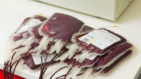 Blutkonserven, tags: Blut Kliniken sparen Blutmanagement Deutschland