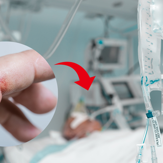 Rundes Bild mit Schnitt an Finger und roter Pfeil auf Hintergrund: Intensivstation