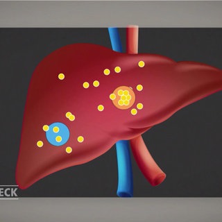 Cholesterin