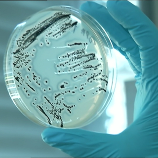 Im Labor zeigt sich: Bei häufiger Einnahme von Antibiotika mutieren auch körpereigene Bakterien und Resistenzen werden gebildet.