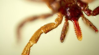 Nahaufnahme eines Zeckenkopfs. Zecken übertragen ein Virus, das FSME auslöst. Schutz bietet eine Impfung.