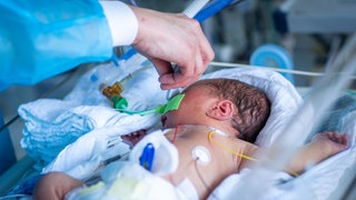 Ein zu früh geborenes Baby wird auf einer Station für "Extrem-Frühgeborene" im Dietrich-Bonhoeffer-Klinikum von einer Krankenschwester versorgt. 