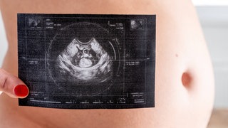 Eine schwangere Frau mit Ultraschallfoto