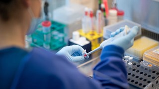 Eine Mitarbeiterin arbeitet mit Abwasserproben. In Stuttgart wurde nun auch Poliovirus im Abwasser nachgewiesen.