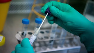 Coronatest