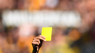 Eine Gelbe Karte (Symbolbild). Nach einem Schienbeinbruch hatte ein Spieler auf Schadensersatz geklagt. Das Landgericht Ellwangen wies die Klage zurück. 