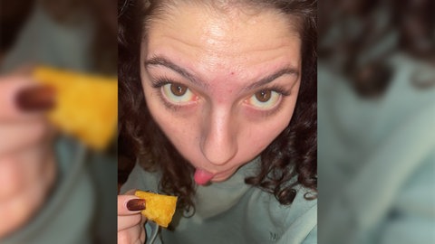 Die Augen so gelb wie ein Tortillachip: Noa vor ihrer Fuchbandwurm-Diagnose.