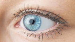 Nicht bei allen Menschen ist die Lederhaut des Auges so strahlend weiß. Verfärbungen können harmlos sein, z. B. bei Menschen, die ohnehin dunklere Haut haben. Sie können aber auch ein Hinweis auf Krankheiten sein und sollten vom Arzt abgeklärt werden.