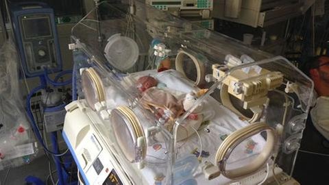 Ein Baby in einem Inkubator. Symbolbild. Einer 42-Jährigen wird vorgeworfen, ihr Baby mit Morphium vergiftet zu haben.
