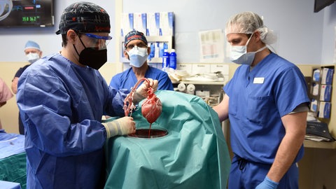 Mitglieder des Operationsteams zeigen im Januar 2022 das Schweineherz, das dem Patienten David Bennett transplantiert werden soll. Das Foto wurde von der Maryland School of Medicine zur Verfügung gestellt. Der Patient starb zwei Monate später.