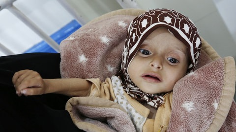 Ein kleines Mädchen, in eine Decke gehüllt: Die Versorung der Bevölkerung im Jemen ist schlecht. Viele Kinder leiden an Hunger und Unterernährung
