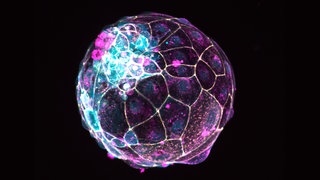Das Bild des Instituts für Molekularbiologie der Österreichischen Akademie der Wissenschaften zeigt einen im Labor hergestellten menschlichen "Blastoiden". Eine Studie von 2021, publziert in "Nature" zeigt, wie Wissenschaftler diese Struktur geschaffen haben, die eine Blastozyste nachahmt – ein Zellknäuel, das sich innerhalb einer Woche nach der Befruchtung bildet und in der Forschung eingesetzt werden kann.