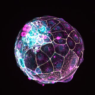 Das Bild des Instituts für Molekularbiologie der Österreichischen Akademie der Wissenschaften zeigt einen im Labor hergestellten menschlichen "Blastoiden". Eine Studie von 2021, publziert in "Nature" zeigt, wie Wissenschaftler diese Struktur geschaffen haben, die eine Blastozyste nachahmt – ein Zellknäuel, das sich innerhalb einer Woche nach der Befruchtung bildet und in der Forschung eingesetzt werden kann.