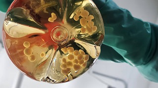 Ein Forscher hält eine Flasche mit Gehirnorganoiden in der Hand: In Organoiden, organähnlichen dreidimensionale Gewebestücken aus menschlichen Zellen, steckt großes Potenzial: An den "Mini-Organen" lassen sich Krankheiten untersuchen.