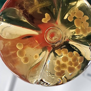 Ein Forscher hält eine Flasche mit Gehirnorganoiden in der Hand: In Organoiden, organähnlichen dreidimensionale Gewebestücken aus menschlichen Zellen, steckt großes Potenzial: An den "Mini-Organen" lassen sich Krankheiten untersuchen.