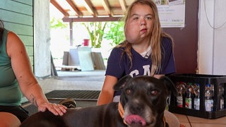 Pia, ein 13-jähriges Mädchen streichelt einen Hund. Aus ihrer rechten Wange wächst ein Tumor.